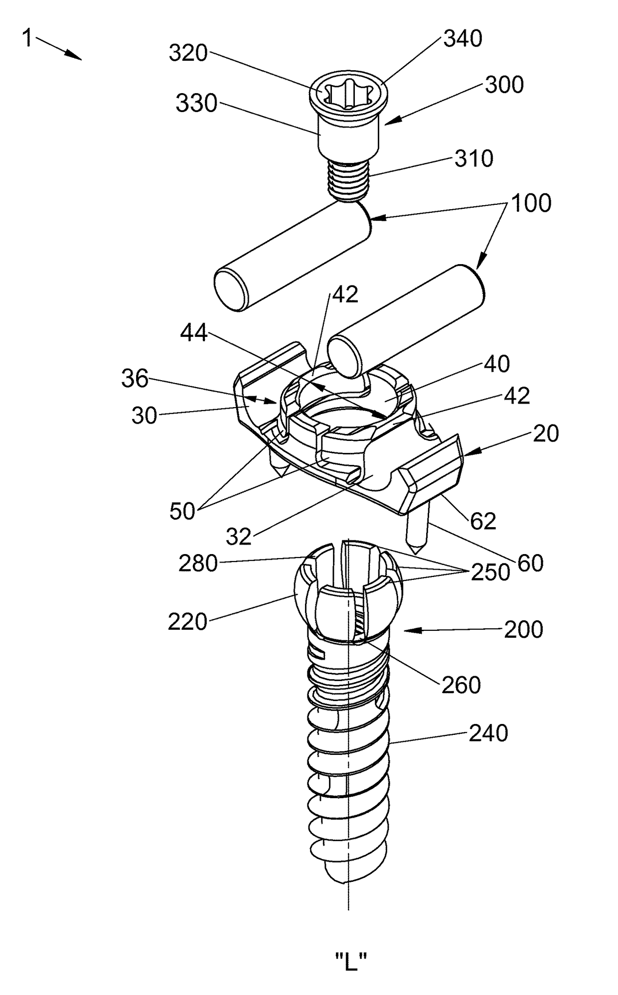 Spinal stabilization system