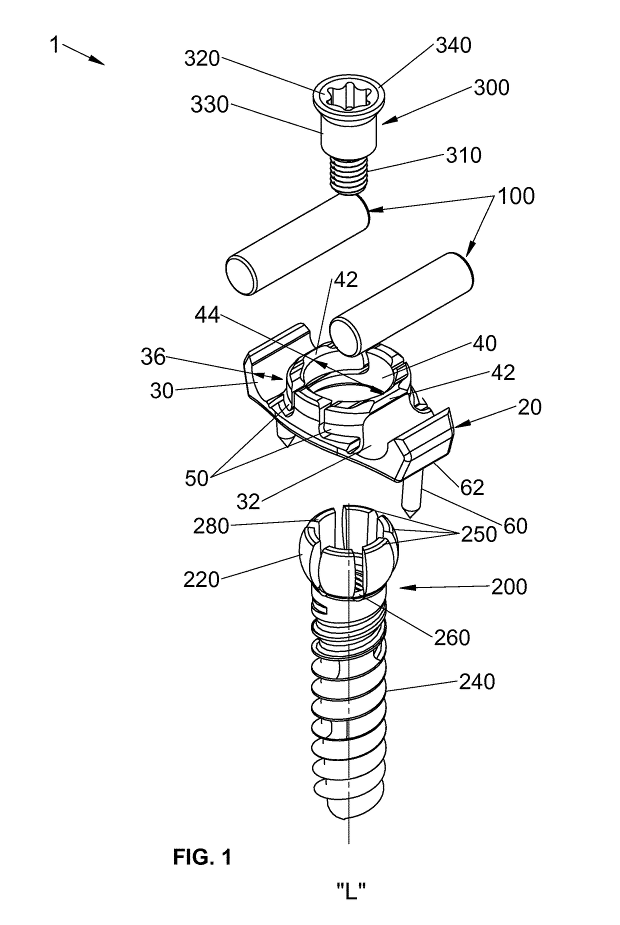 Spinal stabilization system