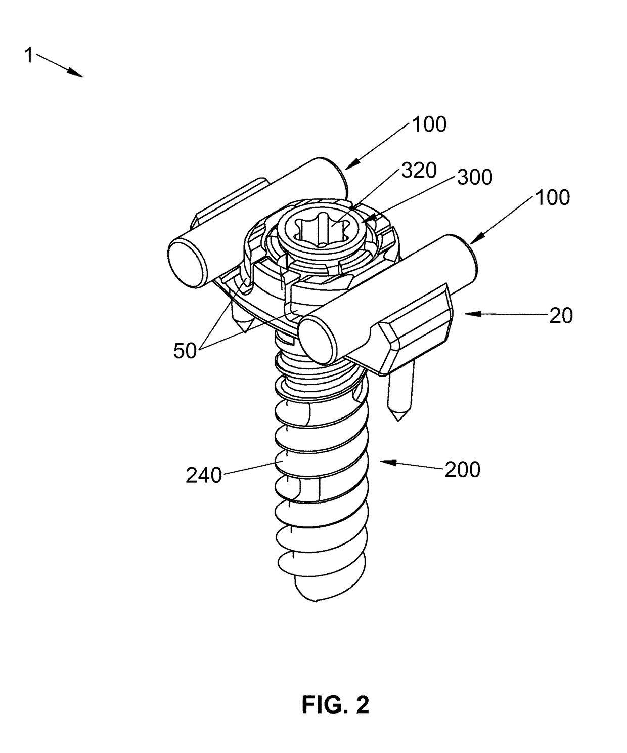 Spinal stabilization system