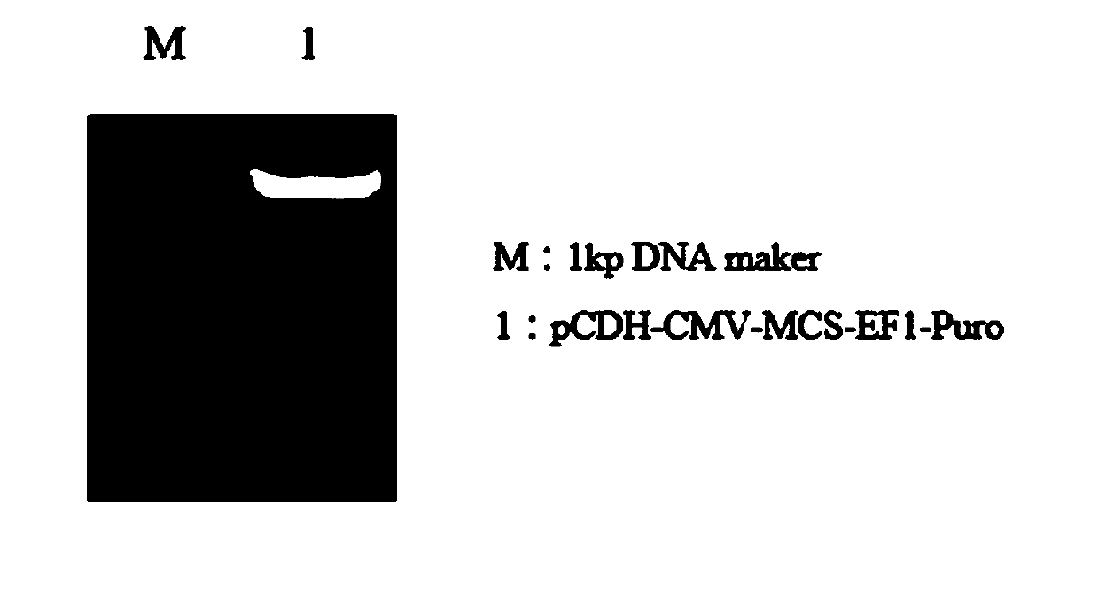 CAR (Chimeric Antigen Receptor) carrier for killing gastric cancer cells by combining MSLN (Mesothelin) single-chain antibody and CCL19 (C-C-Motif Ligand 19) as well as constructing method and application thereof