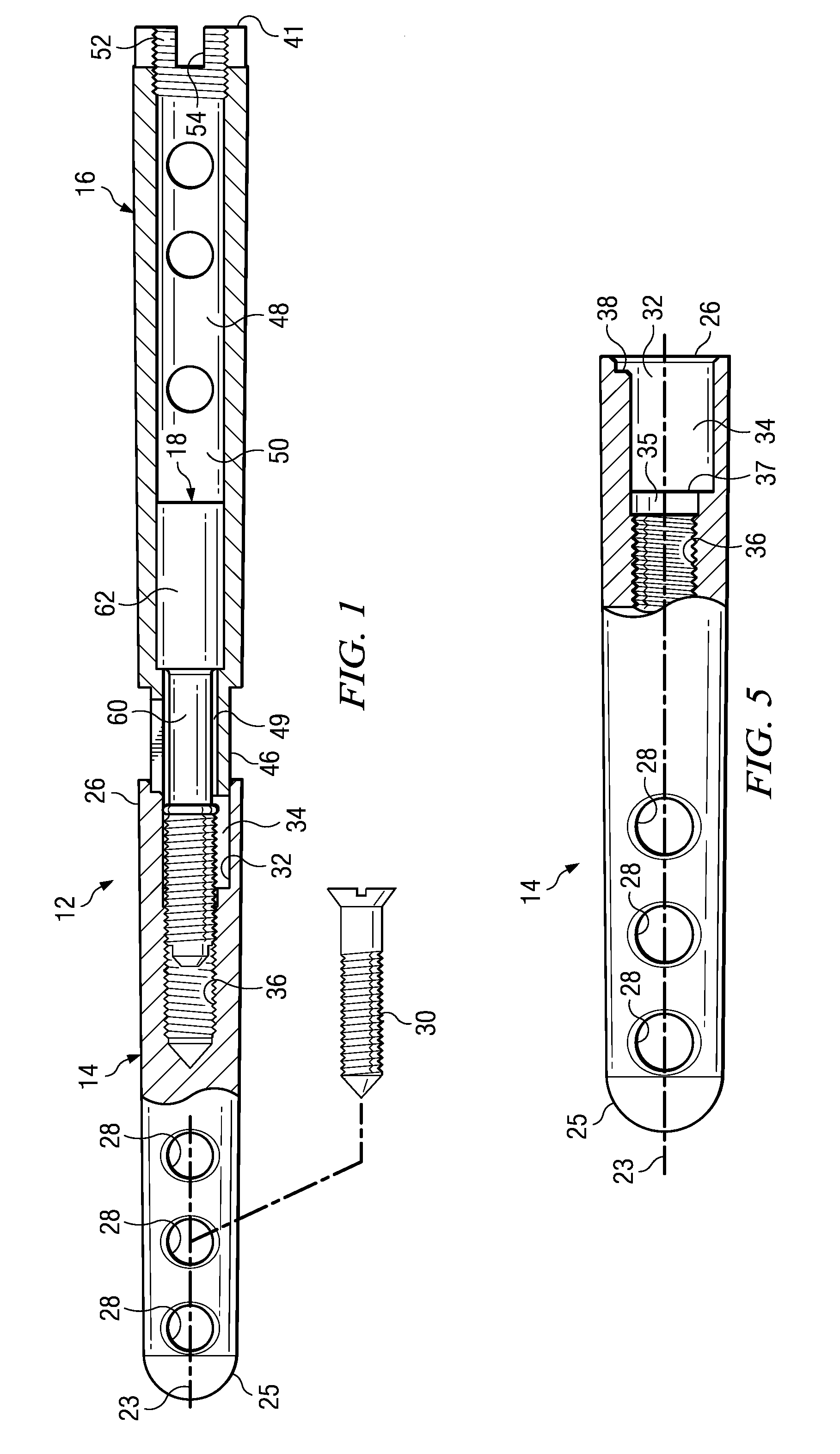 Ankle arthrodesis nail and outrigger assembly