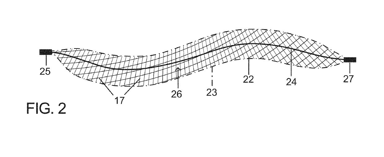 Micro-macro endovascular occlusion device and methodology