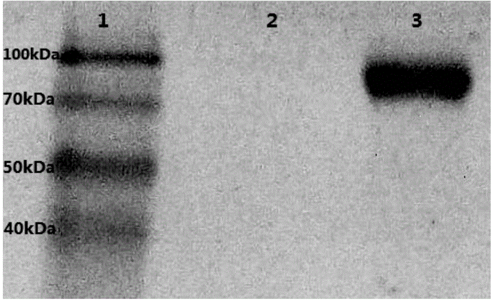 Recombinant pichia pastoris bacterial strain for co-expressing inulin excision enzyme and incision enzyme as well as construction method and application of bacterial strain