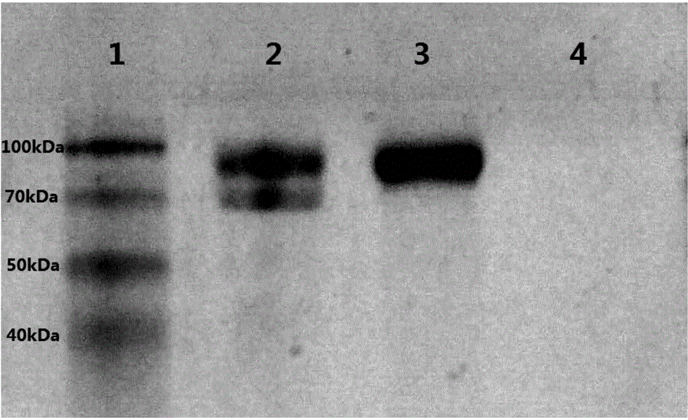 Recombinant pichia pastoris bacterial strain for co-expressing inulin excision enzyme and incision enzyme as well as construction method and application of bacterial strain