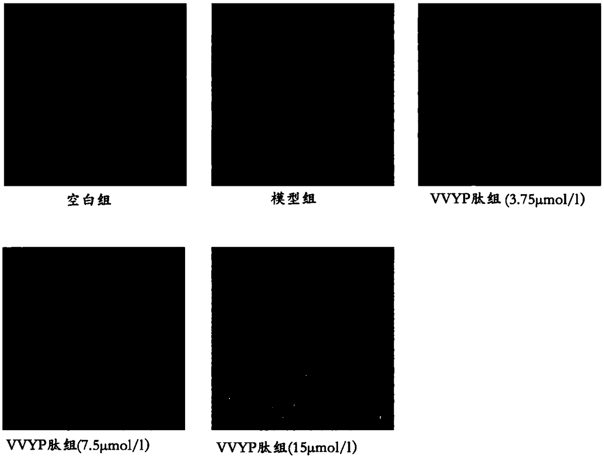 Application of VVYP peptide or salt thereof in preparing medicine for preventing or treating non-alcoholic fatty liver disease