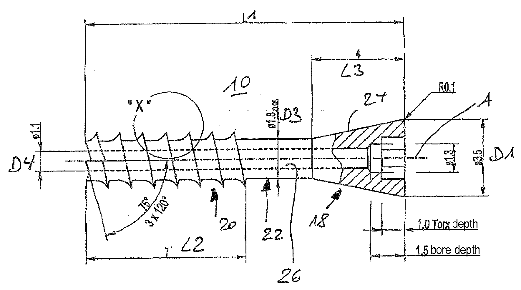 Orthopedic compression screw