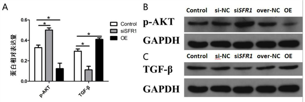 lncrna SFR1 and its application, products and methods for regulating follicle development