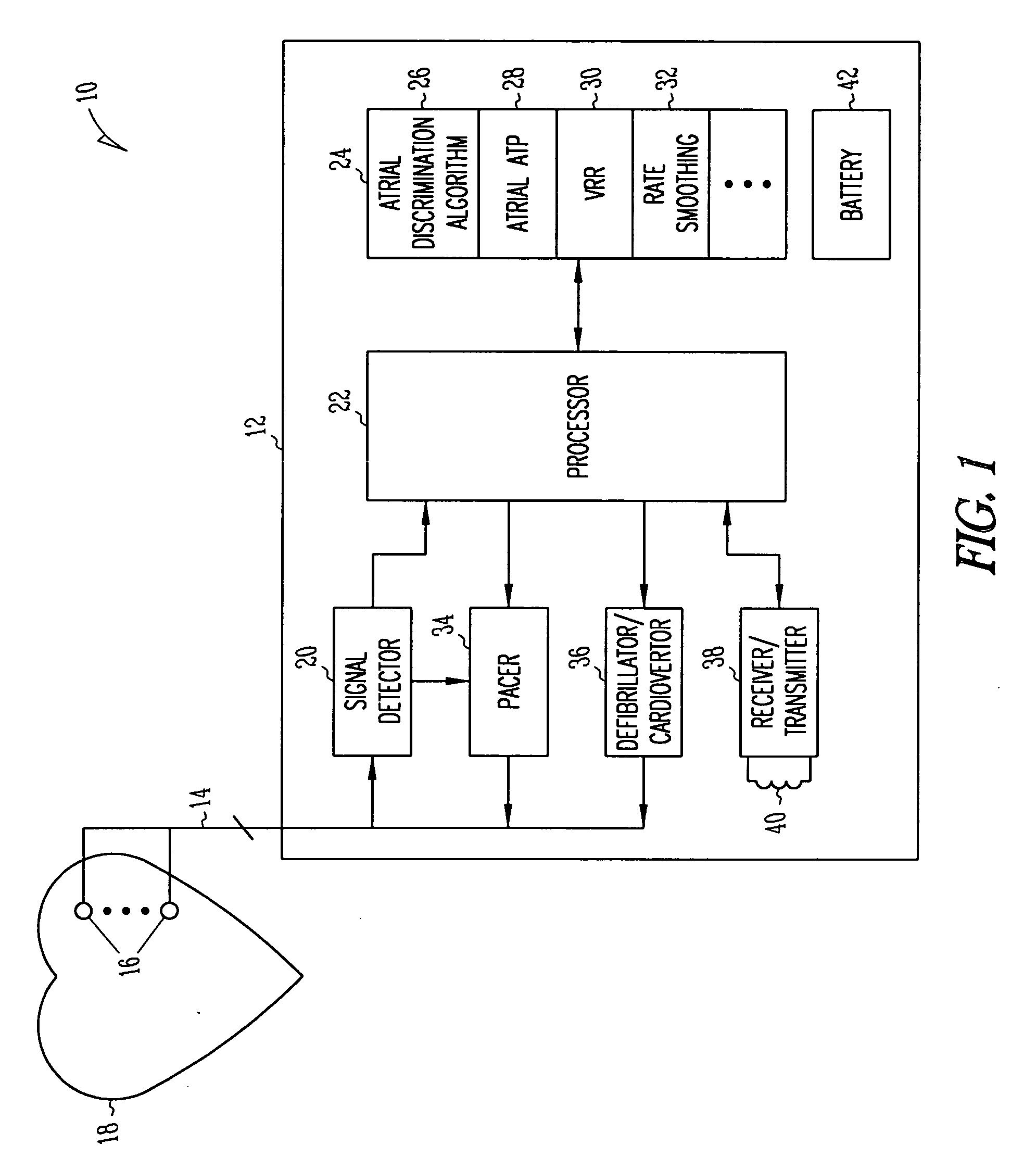 Method and apparatus for using atrial discrimination algorithms to determine optimal pacing therapy and therapy timing