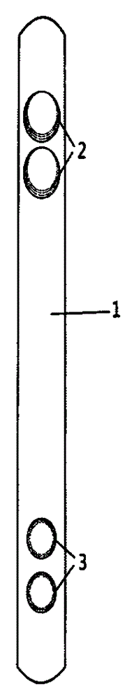 Locking support for treating femoral intertrochanteric fracture through minimally invasive therapy