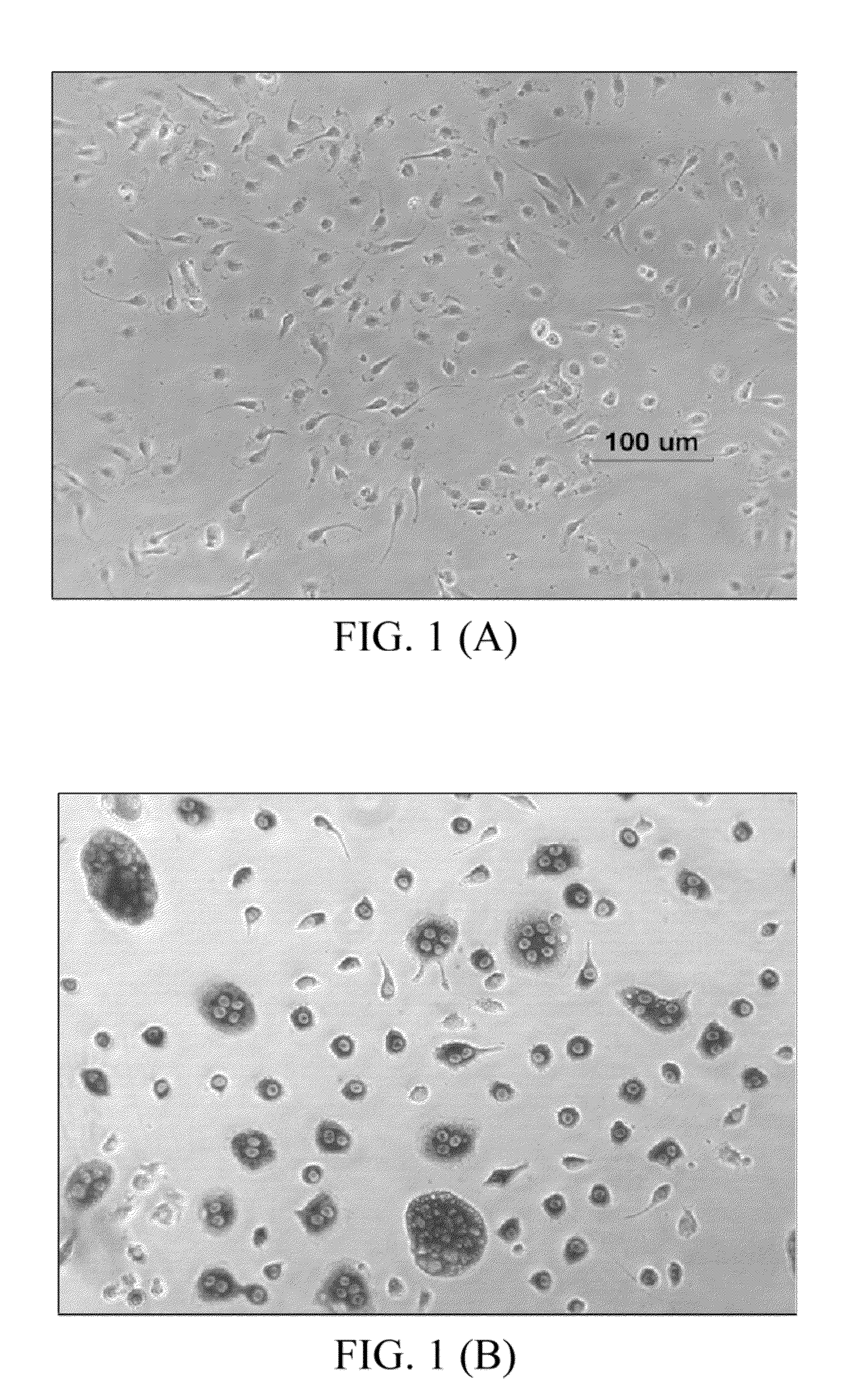 Method of preventing and treating osteoporosis