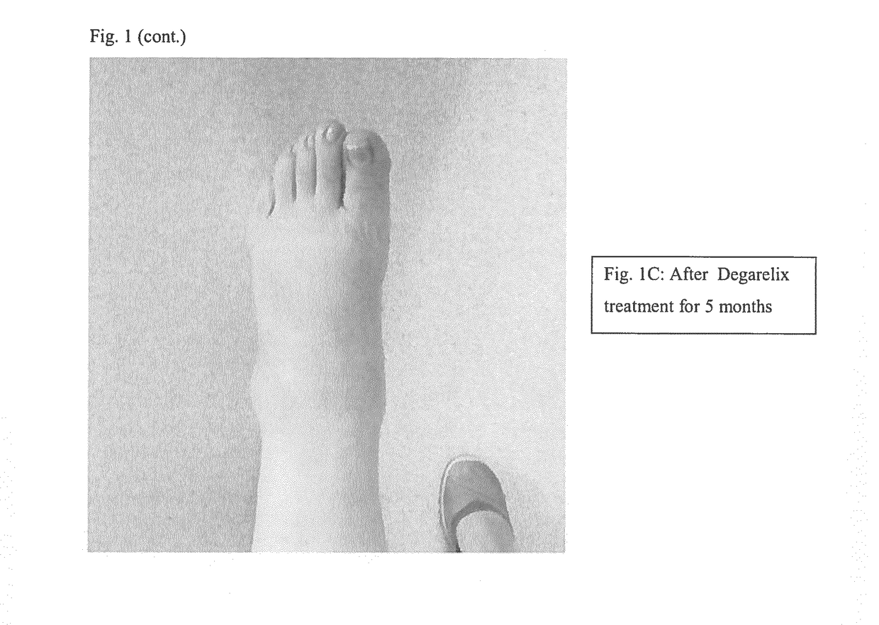 Methods, agents and compositions for treatment of inflammatory conditions