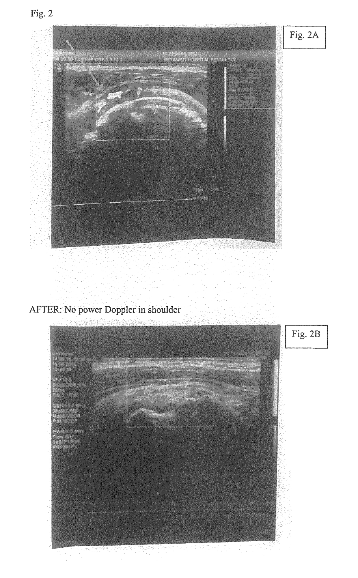 Methods, agents and compositions for treatment of inflammatory conditions