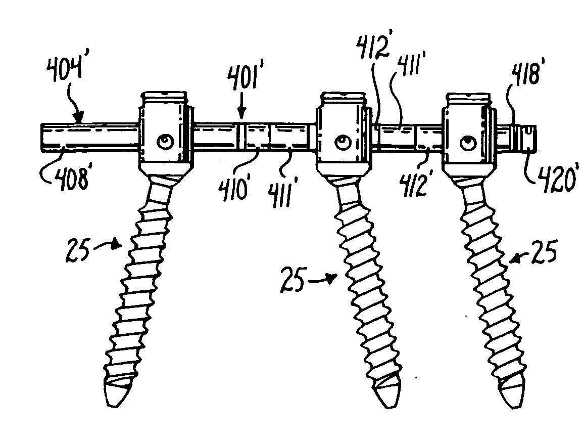 Dynamic stabilization connecting member with pre-tensioned solid core