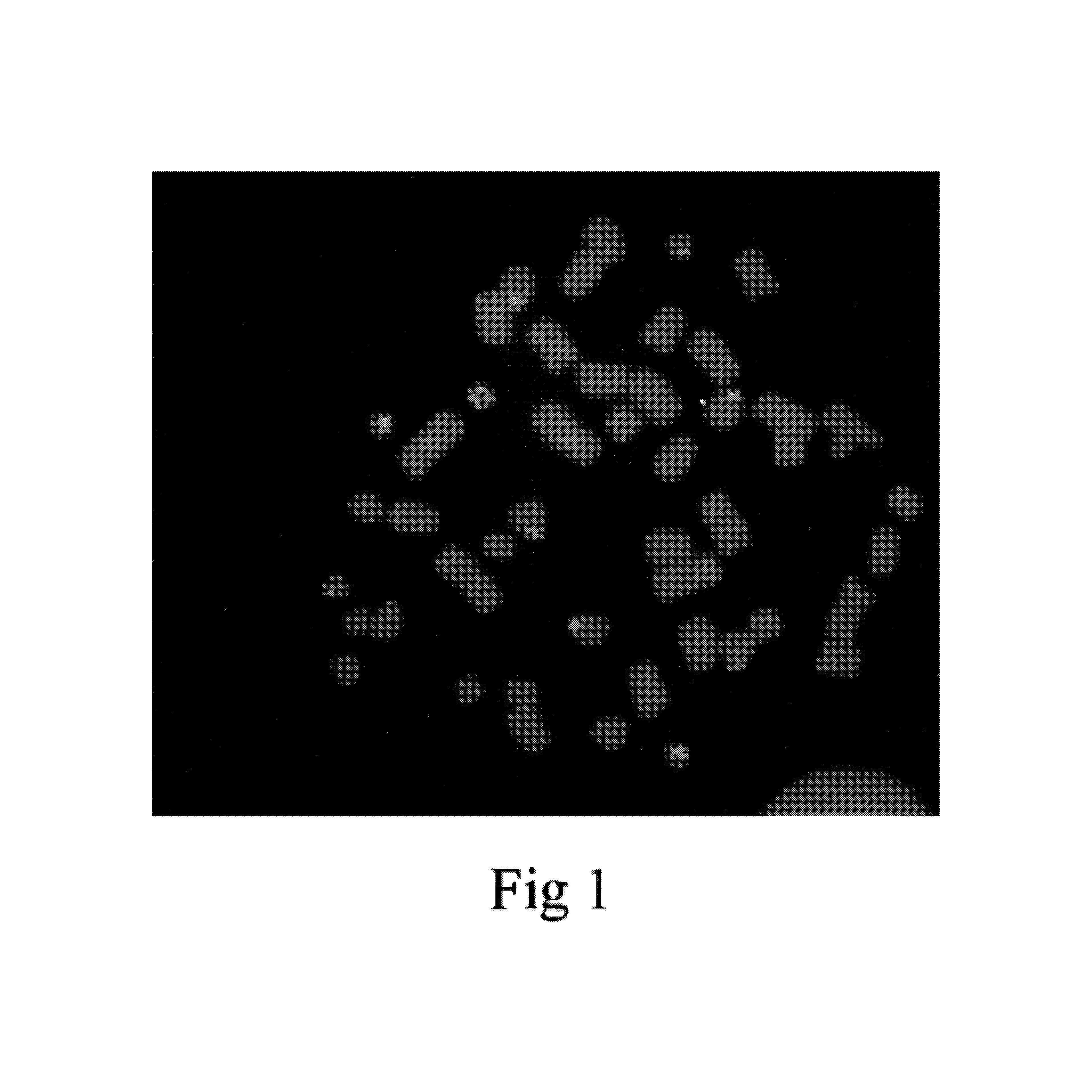 Gene therapy agent for Haemophilia B and its preparation method