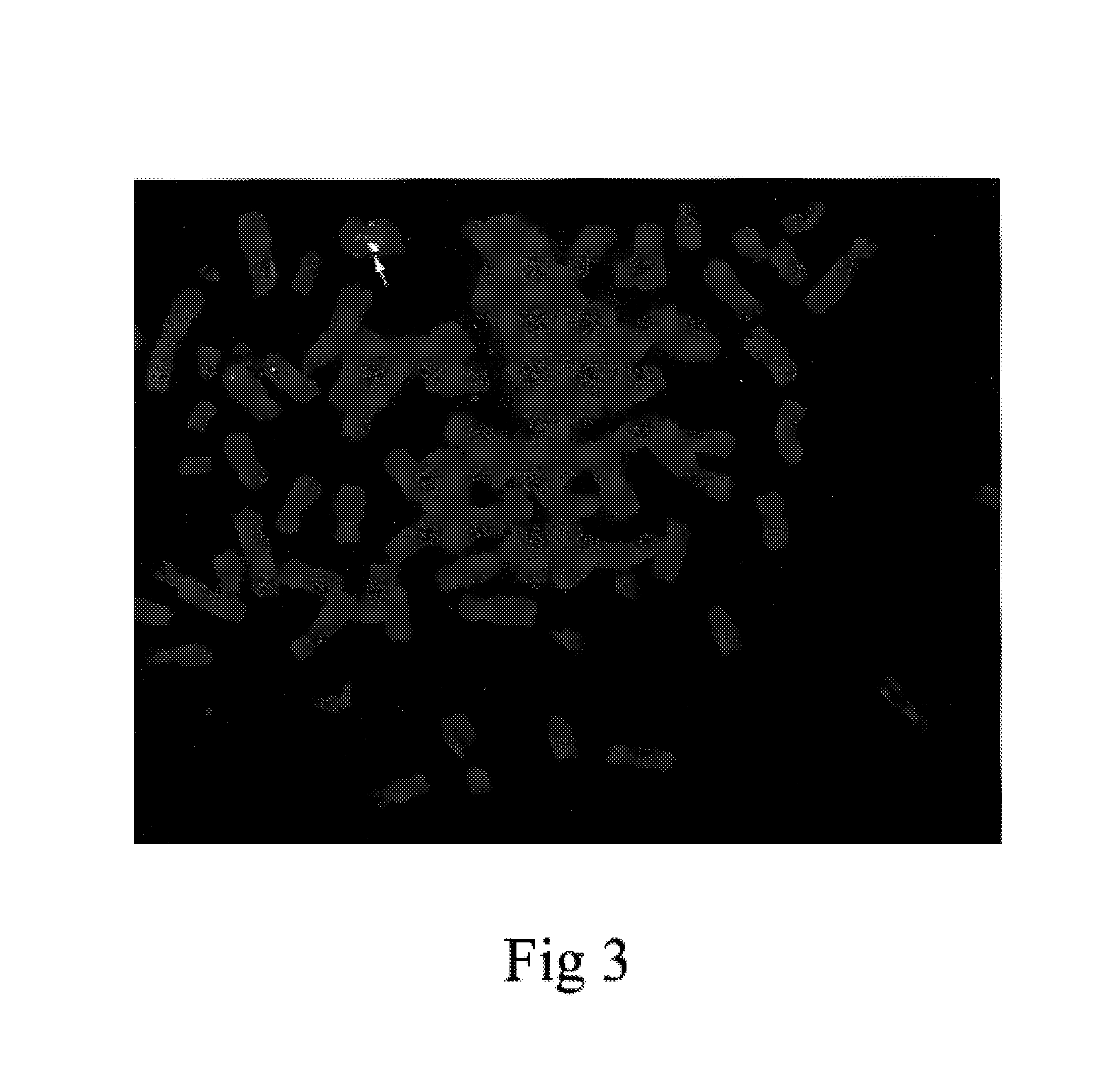 Gene therapy agent for Haemophilia B and its preparation method