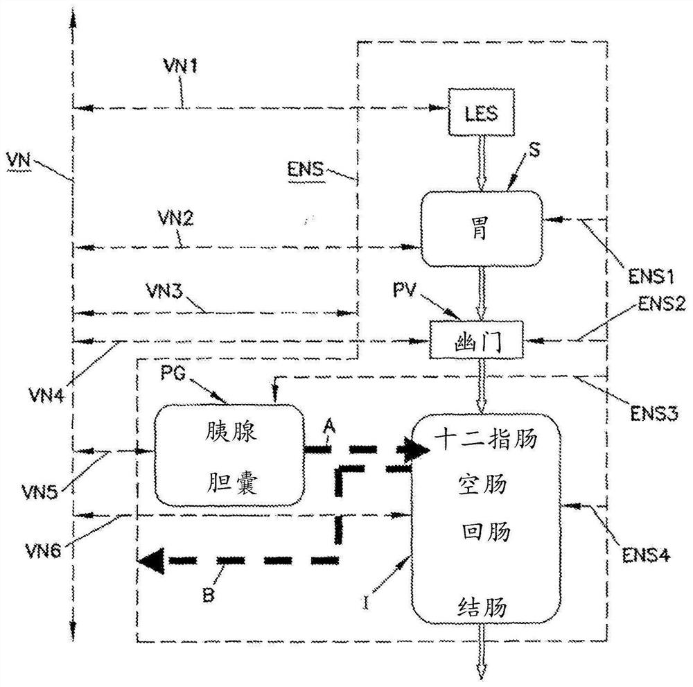 Simultaneous multi-site vagus nerve neuromodulation for improved glycemic control system and methods