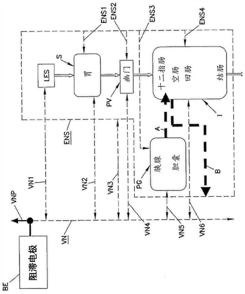 Simultaneous multi-site vagus nerve neuromodulation for improved glycemic control system and methods