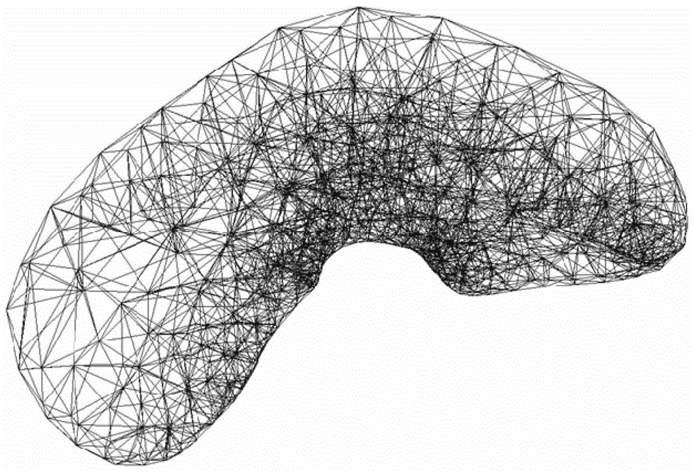 A real-time simulation method of buried suture technology