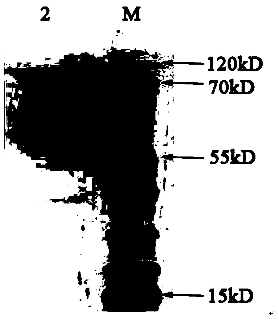 Preparation method and application method of chlamydia pneumoniae recombinant antigen