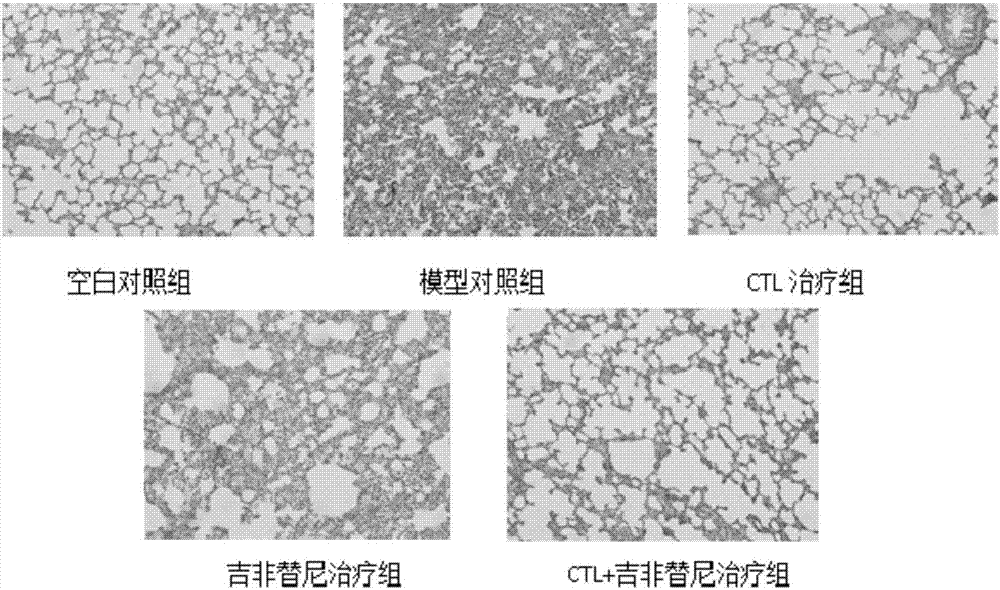 Antigen peptide T790M-7 and application thereof in preparation of drug for treating non-small cell lung cancer