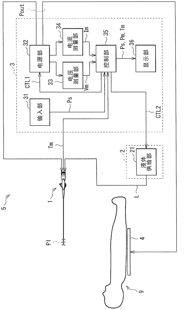 Catheter system