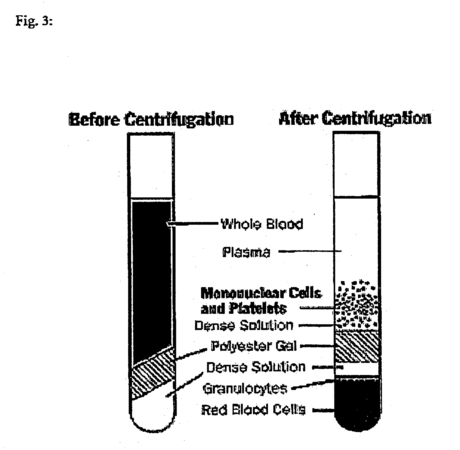 Method for detection of inflammatory processes