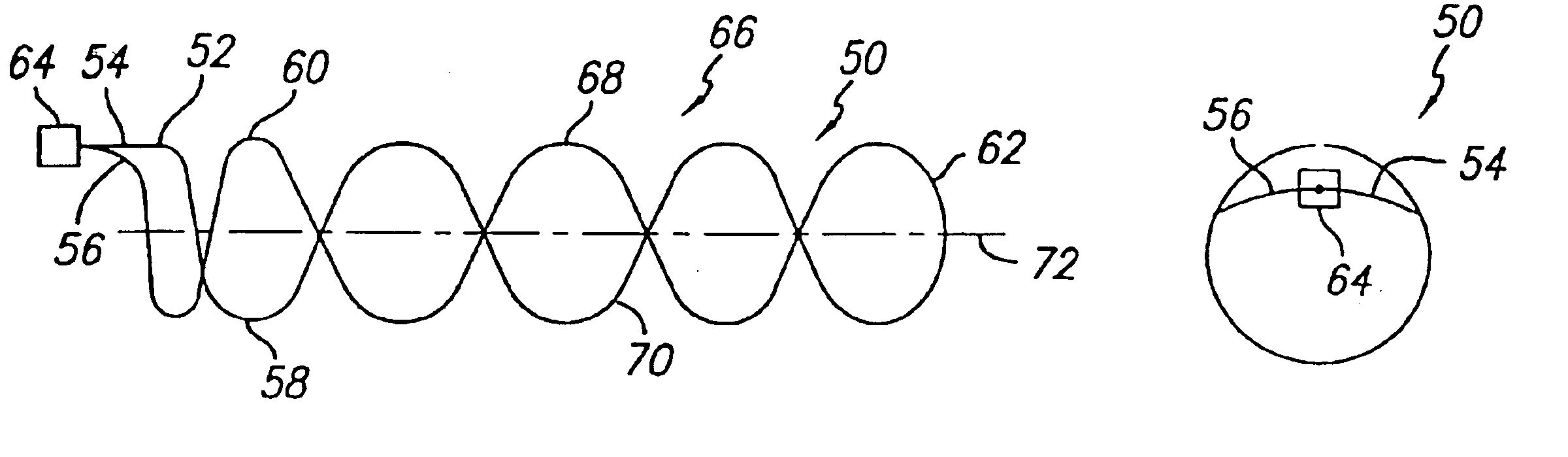 Intravascular flow modifier and reinforcement device