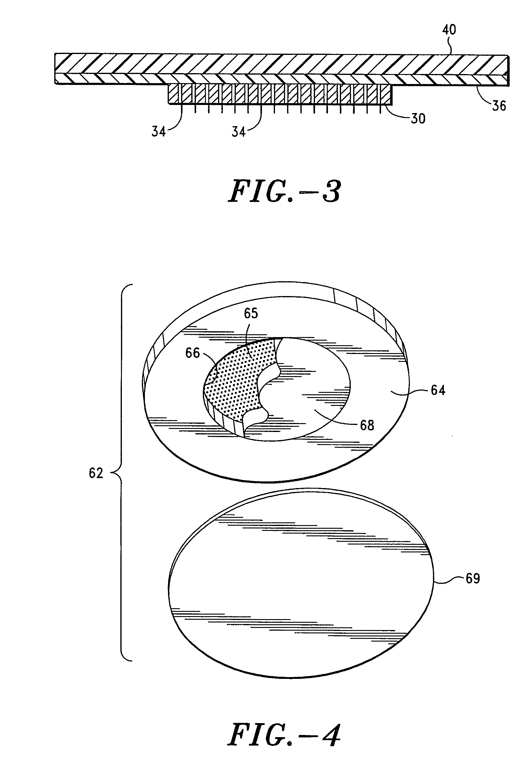 Apparatus and method for transdermal delivery of natriuretic peptides