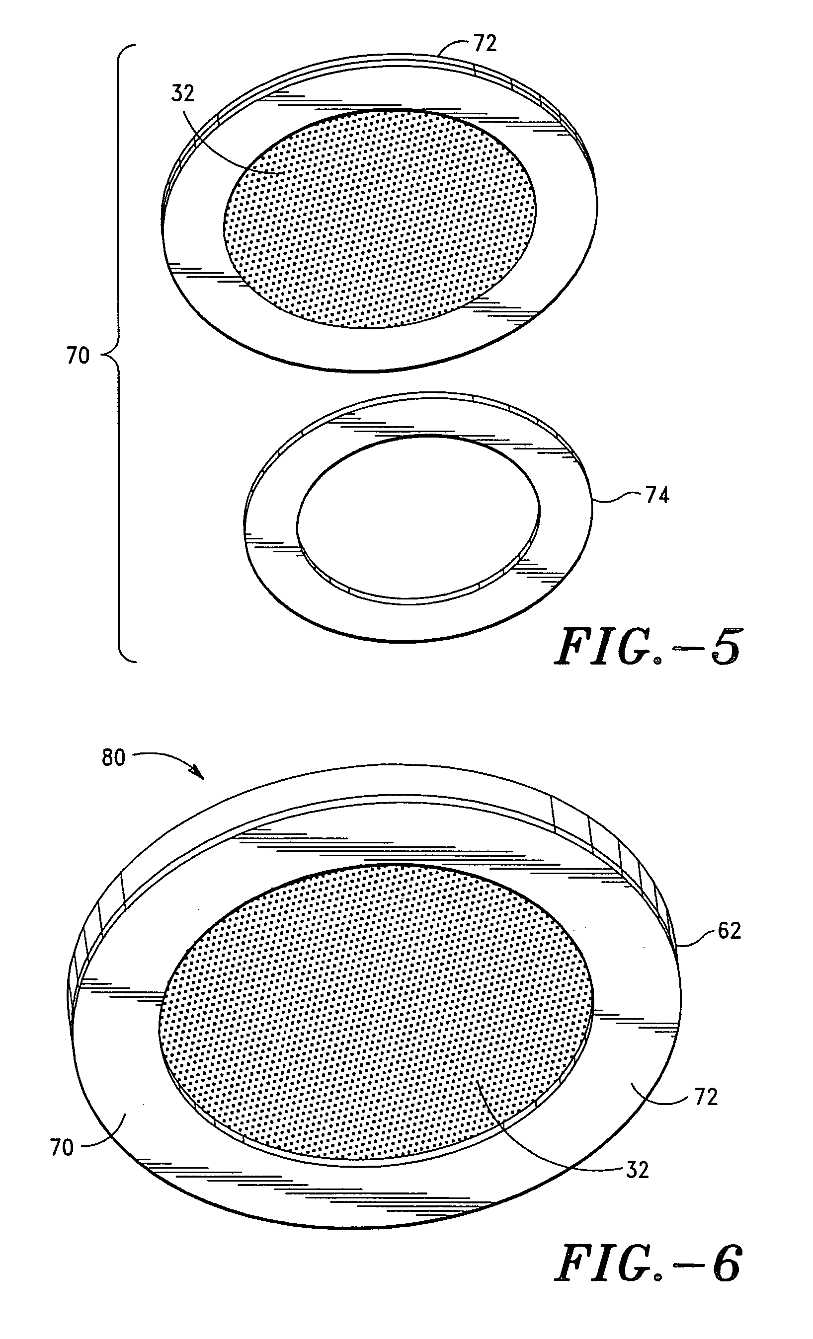 Apparatus and method for transdermal delivery of natriuretic peptides