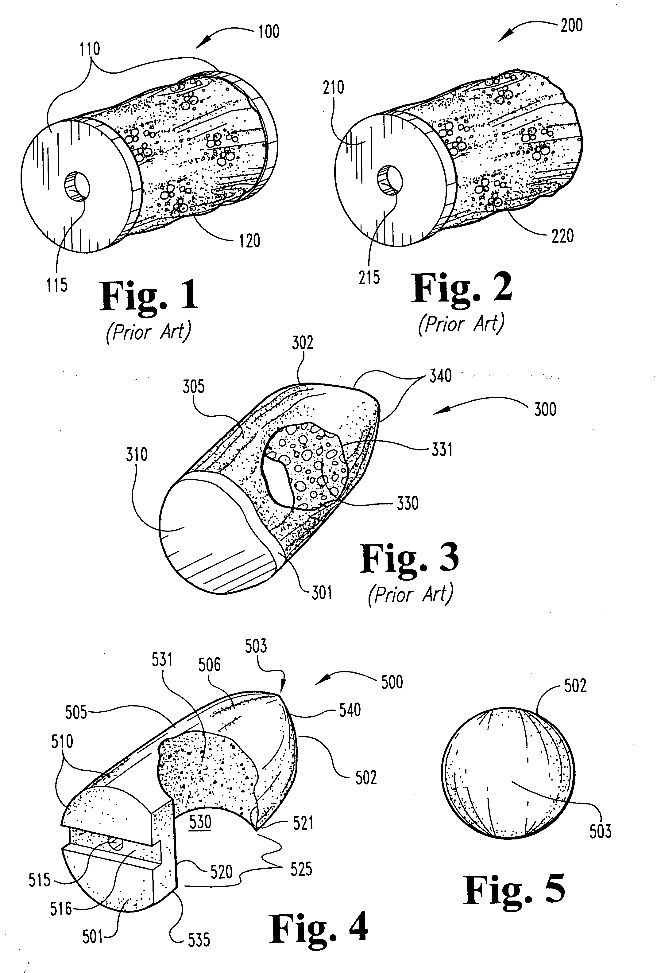 Open intervertebral spacer