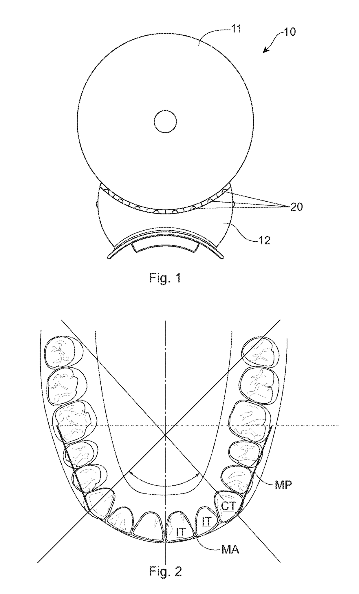 Tooth-whitening process