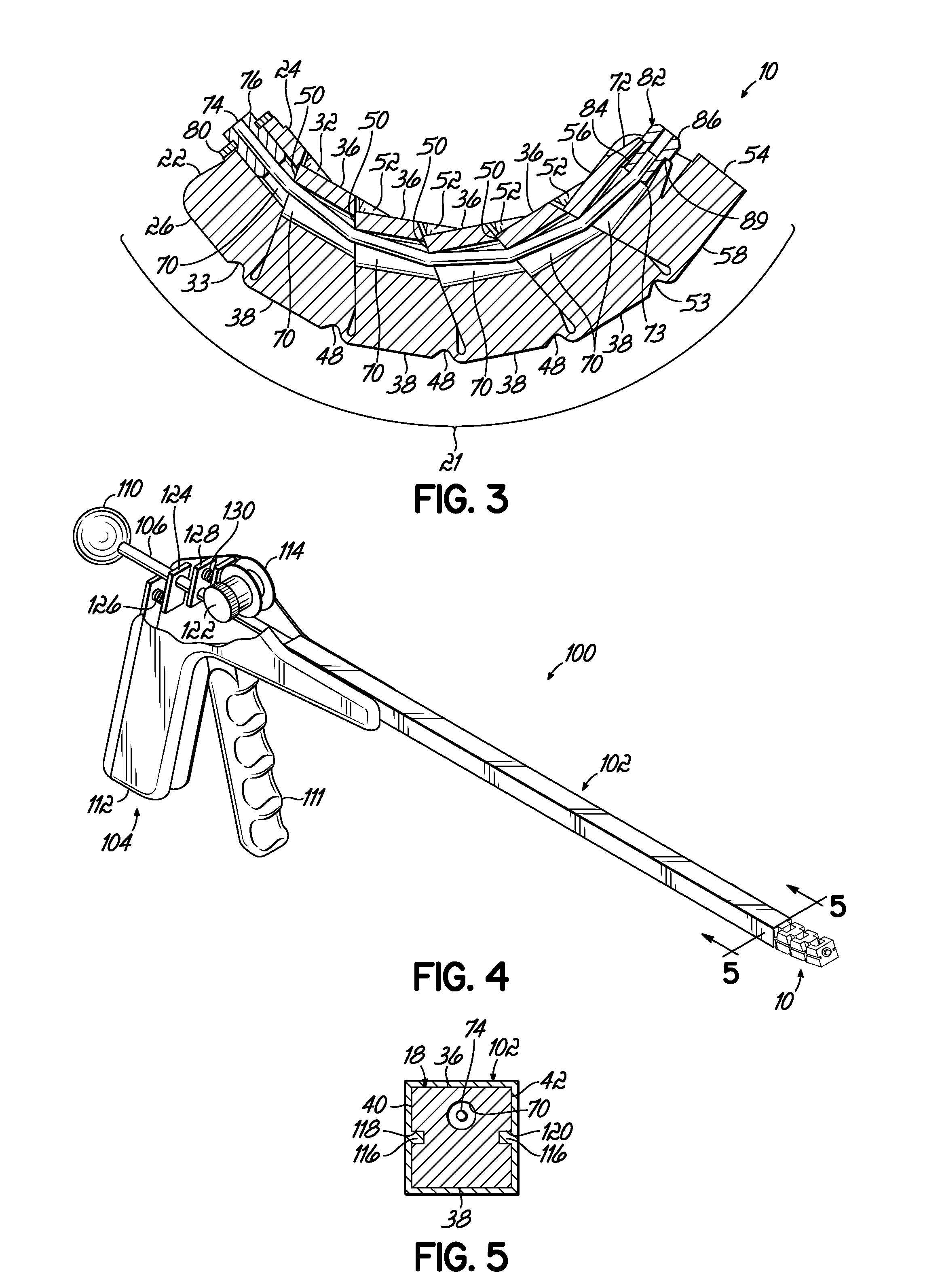 Deployable segmented tlif device