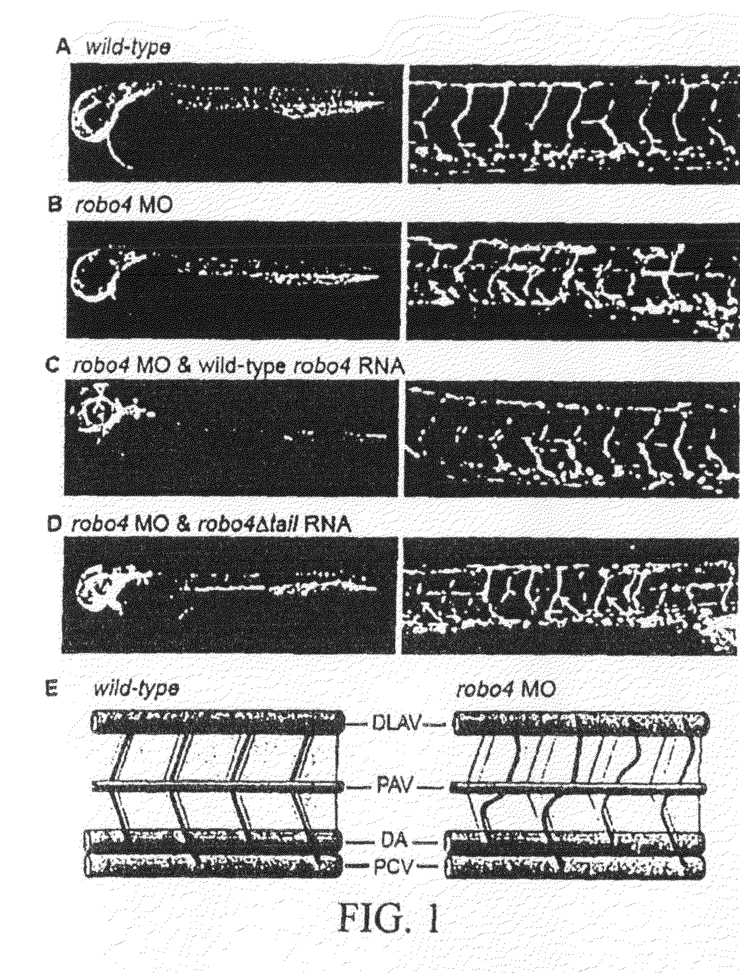 Compositions and methods for treating pathologic angiogenesis and vascular permeability