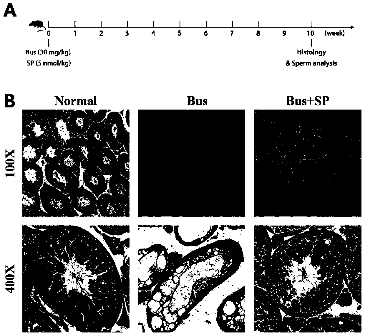 Application of SP in preparation of drug for treating male infertility