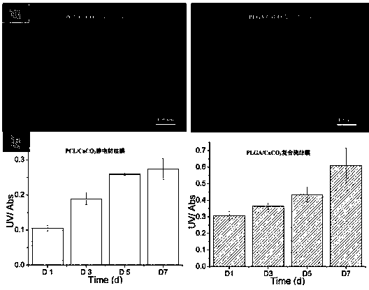 A scaffold material with gradient activity for osteochondral interface repair and its preparation method and application