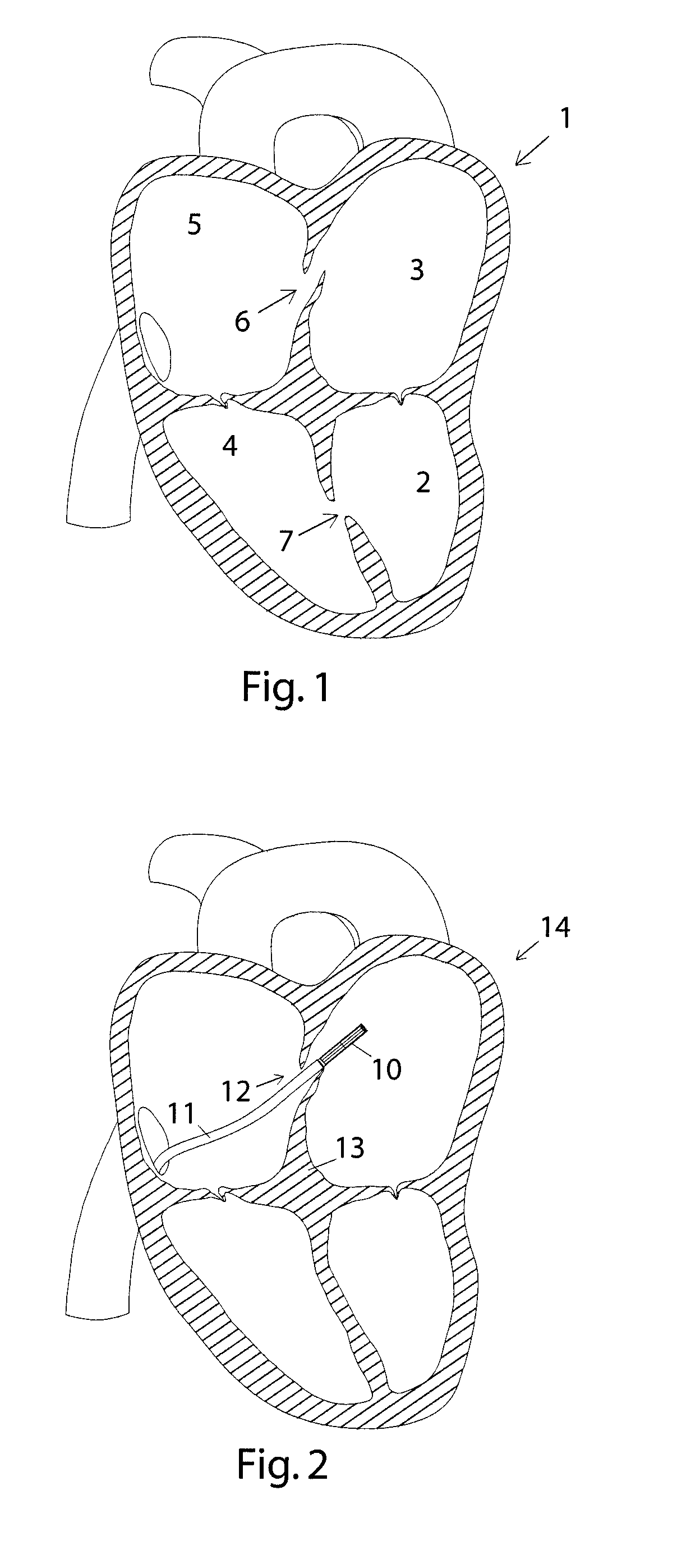 Closure device and insertion assembly