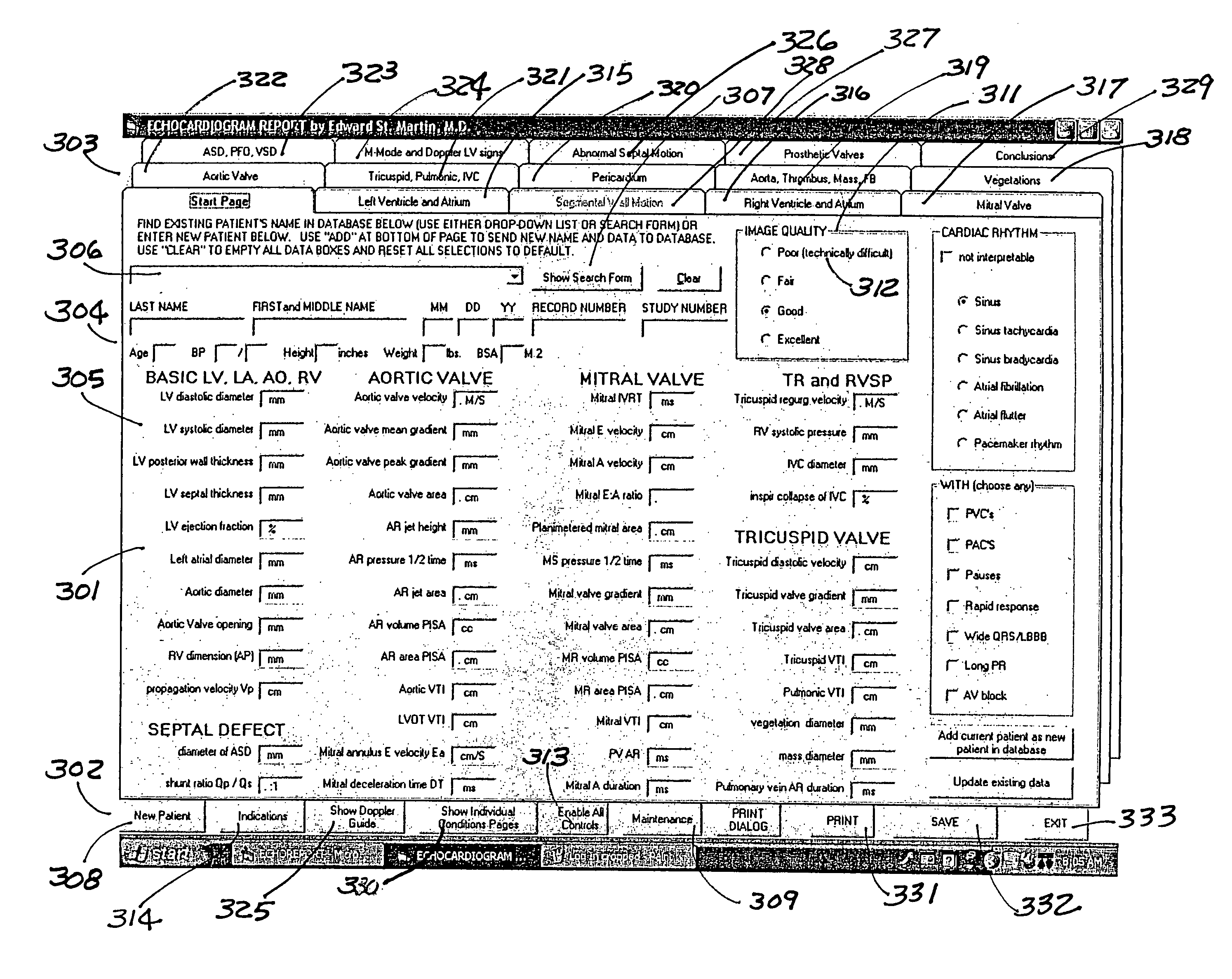 Method and system for generating an echocardiogram report