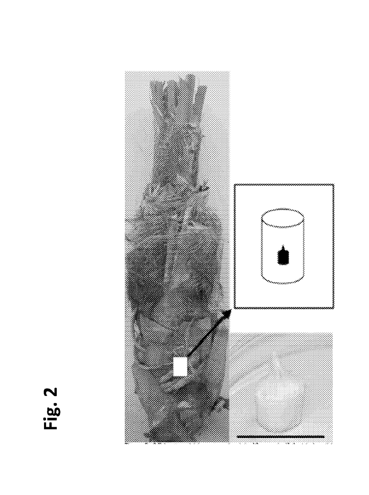 Micropropagation of date palm