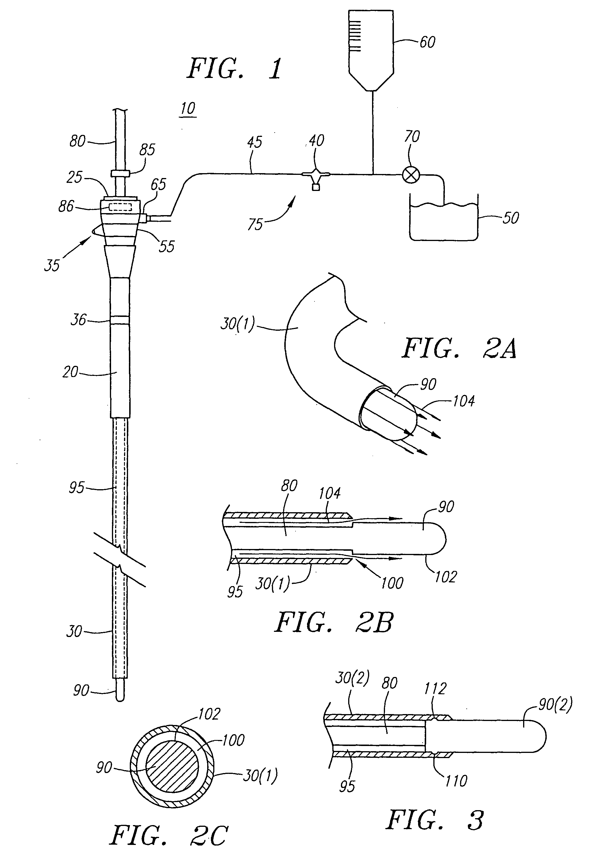 Irrigation sheath