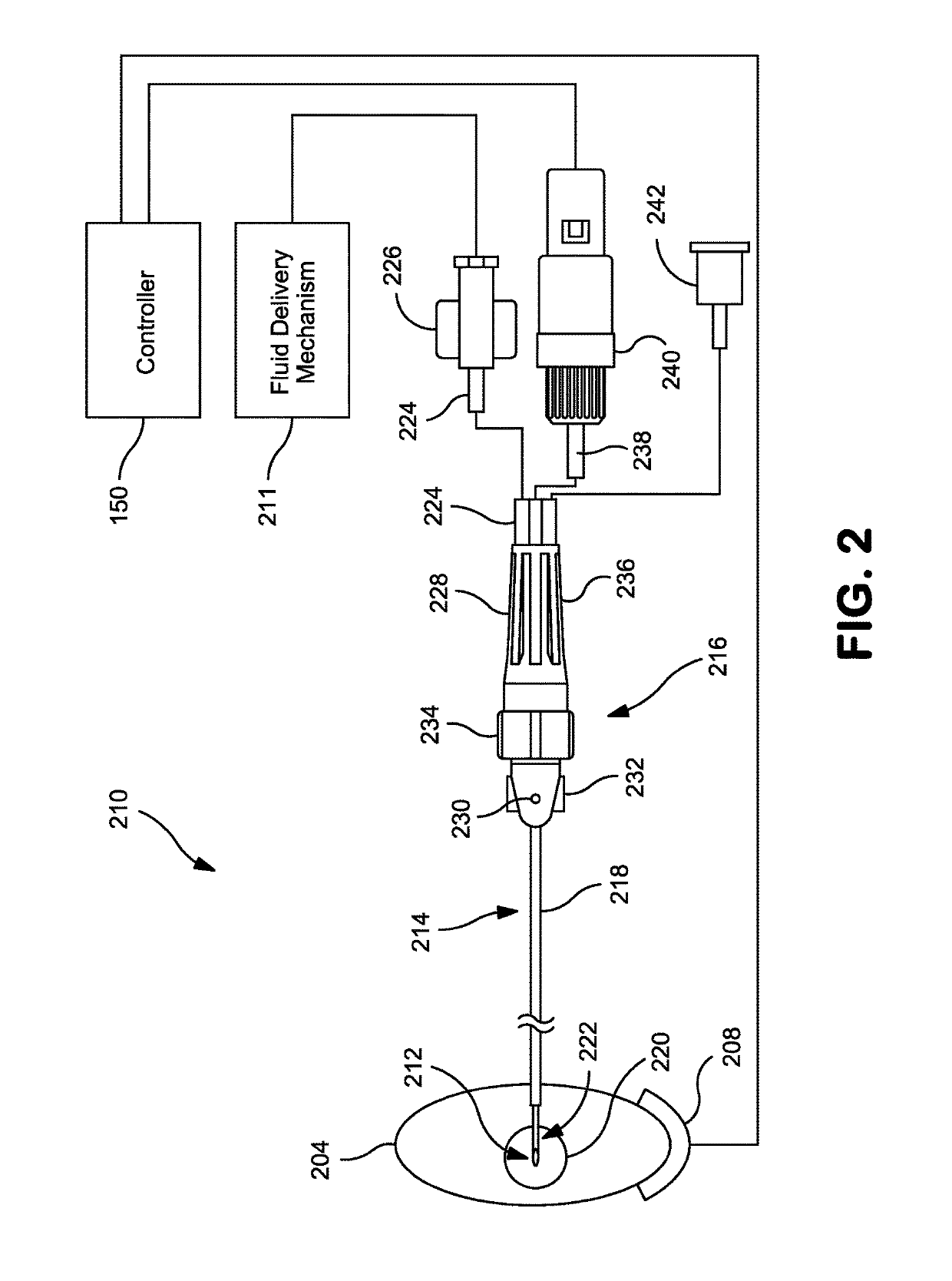 Method and system for identification of source of chronic pain and treatment