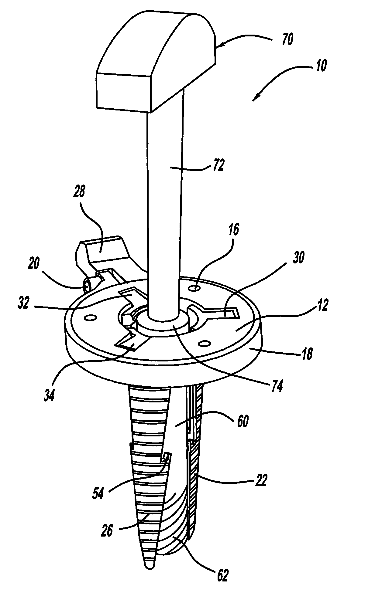 Minimally invasive surgical access device