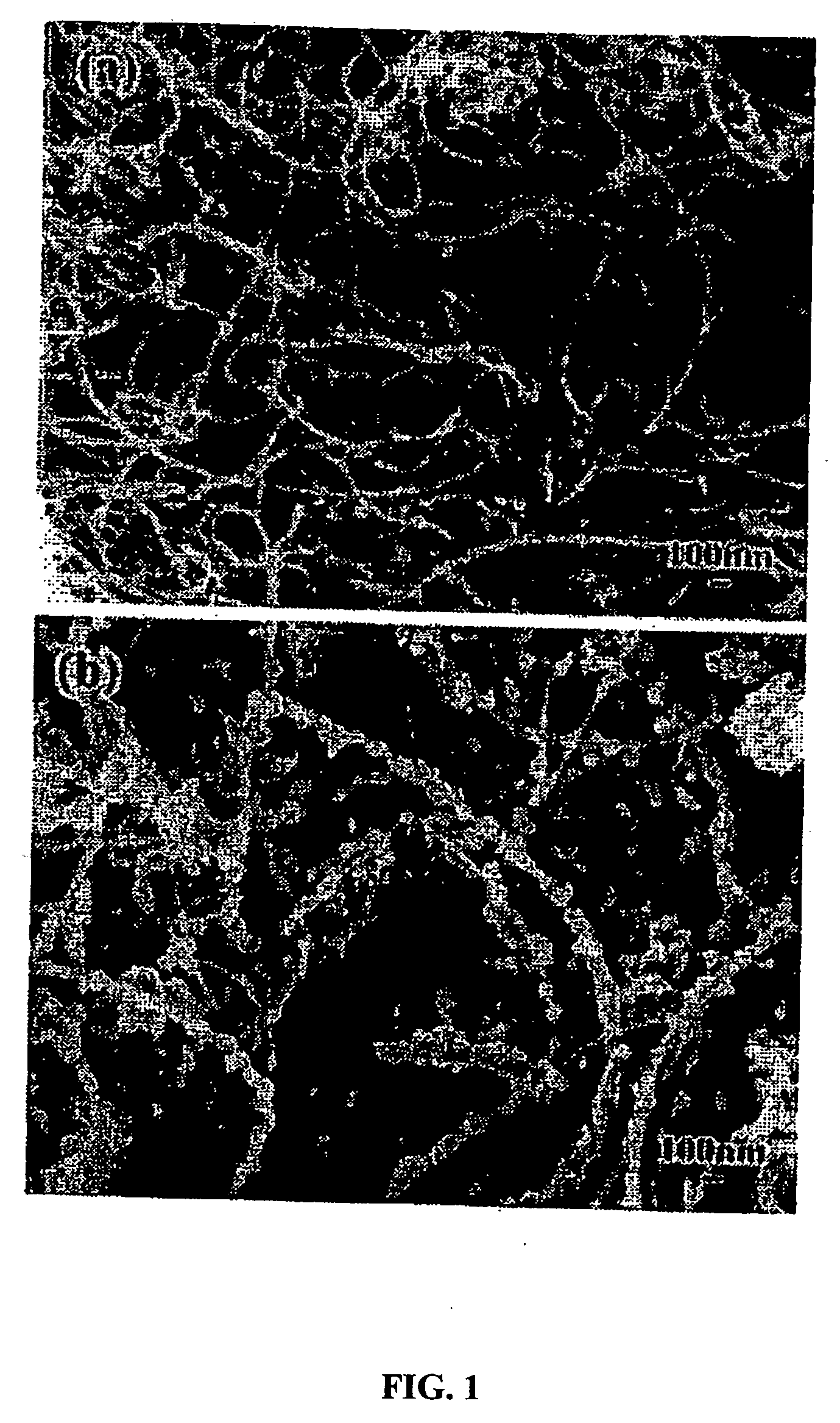 Synthesis of boron carbide nanoparticles