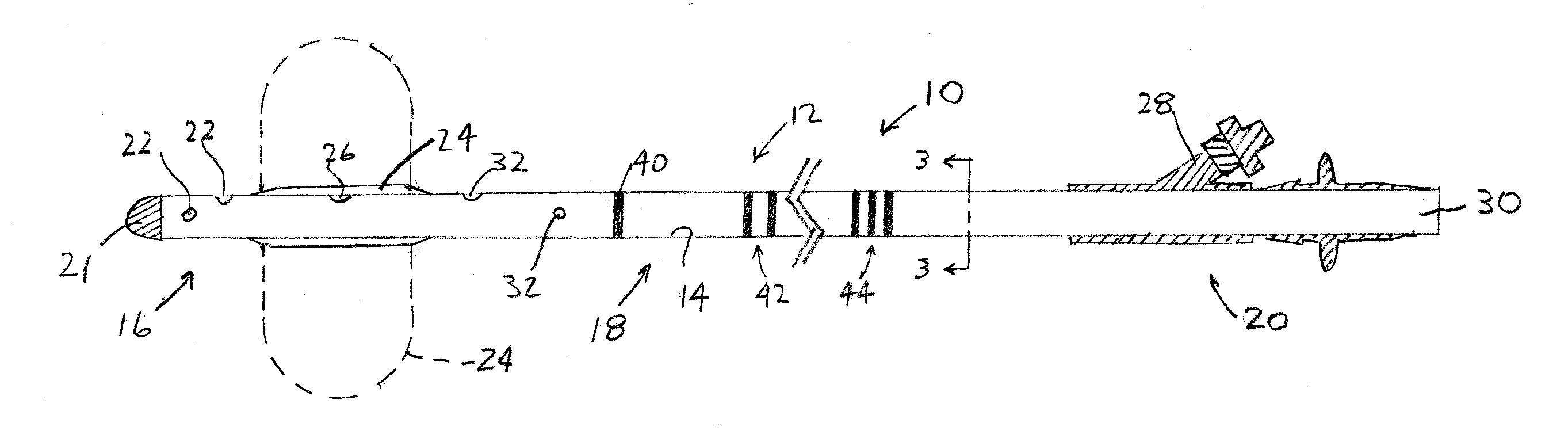 Left Heart Vent Catheter