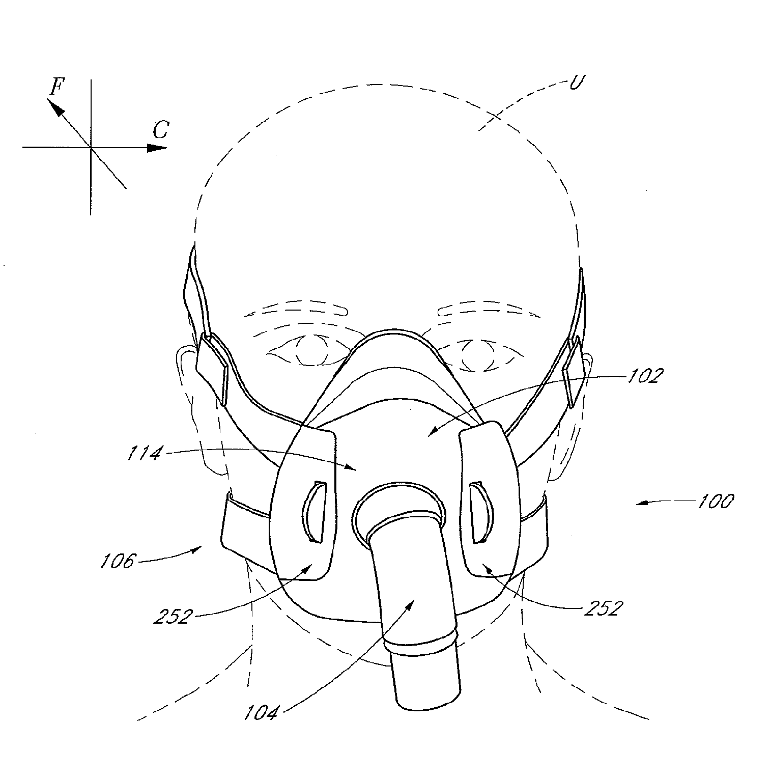 Interface comprising a rolling nasal bridge portion