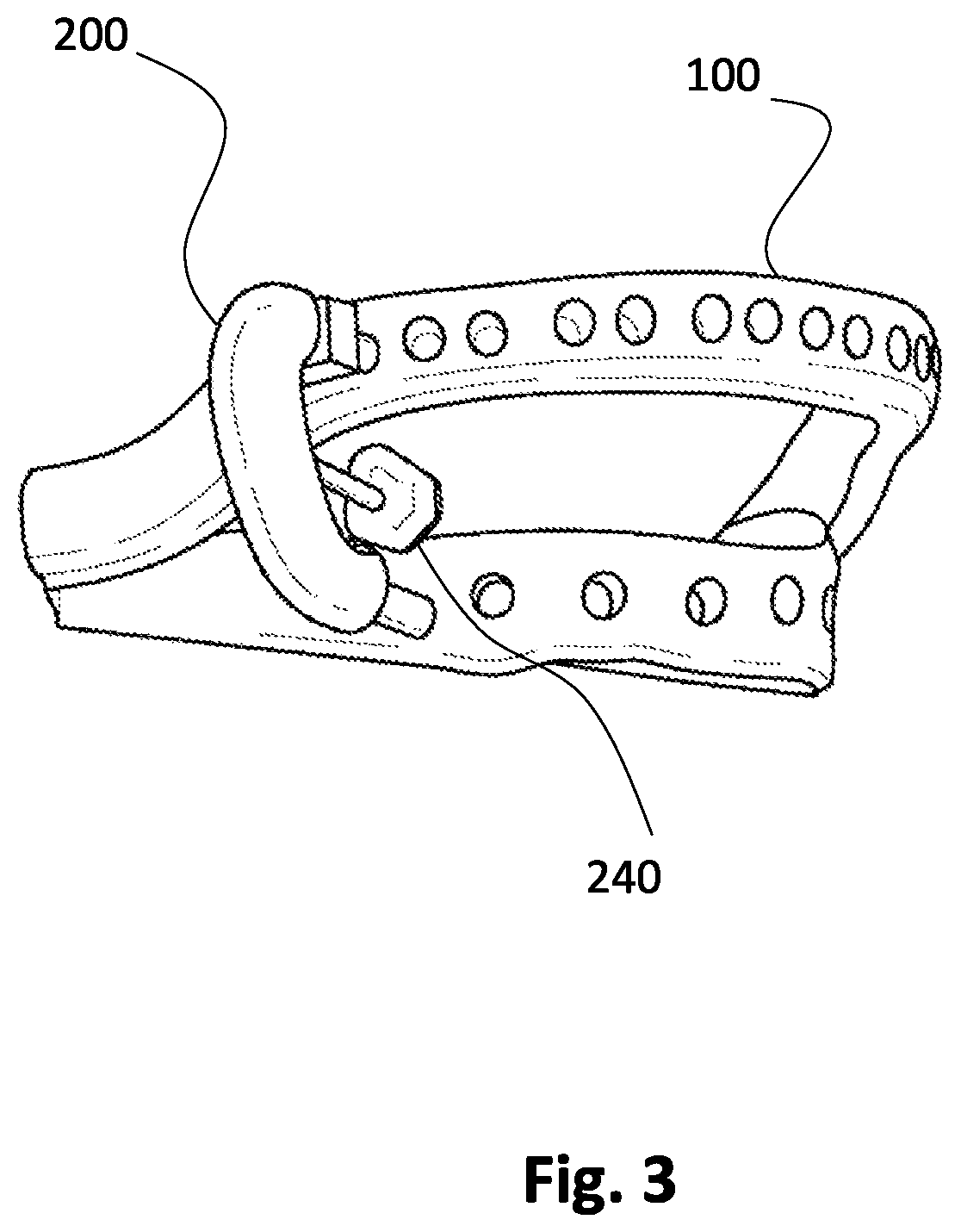 Assembly for fabricating dental veneer