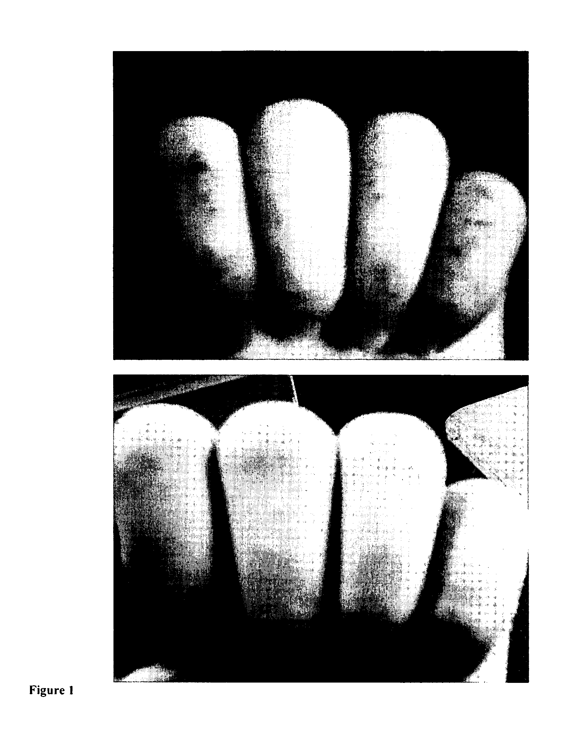 Compositions containing lipid micro- or nanoparticles for the enhancement of the dermal action of solid particles