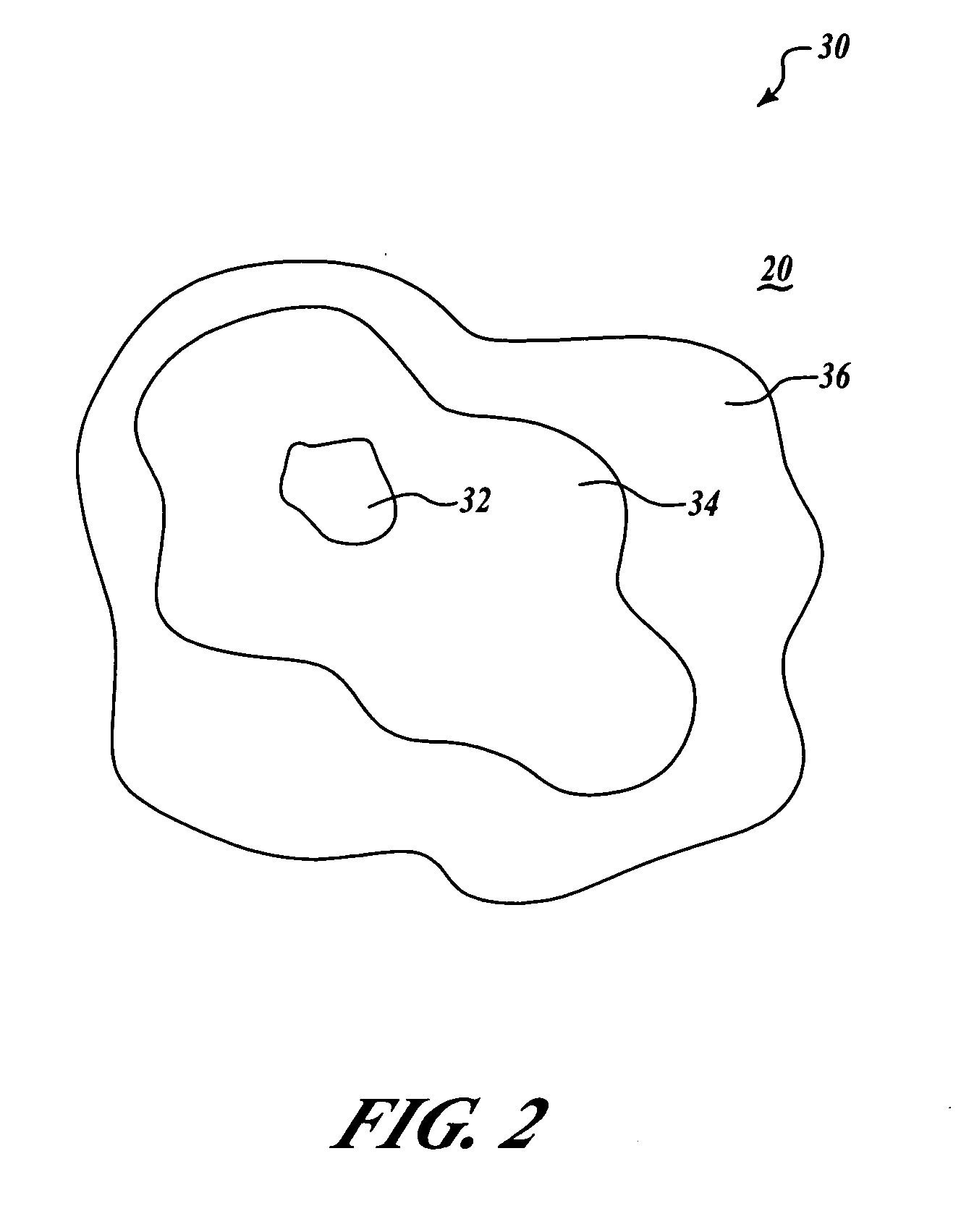 Systems and methods for thermographic inspection of composite structures