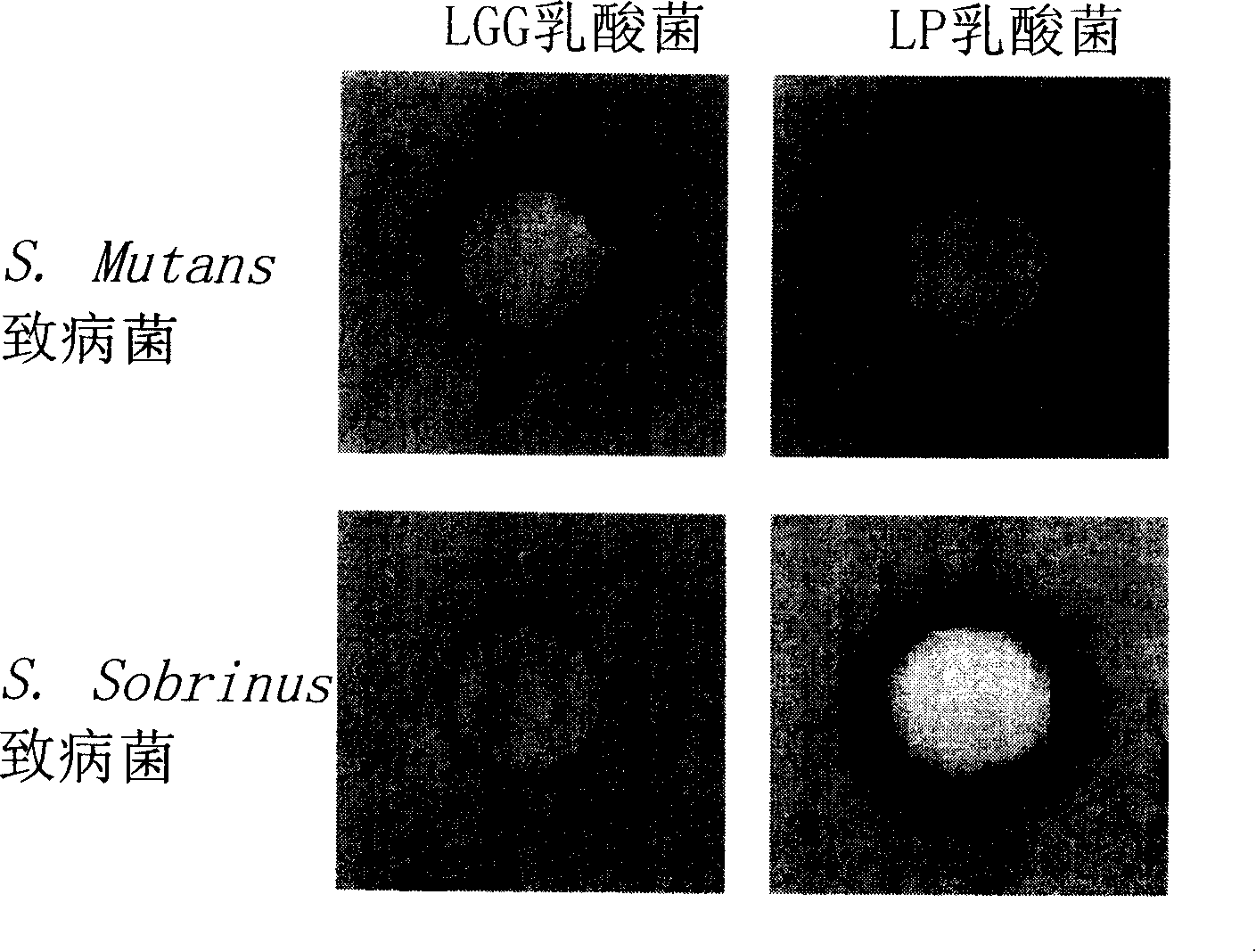 Products containing LP lactic acid bacteria