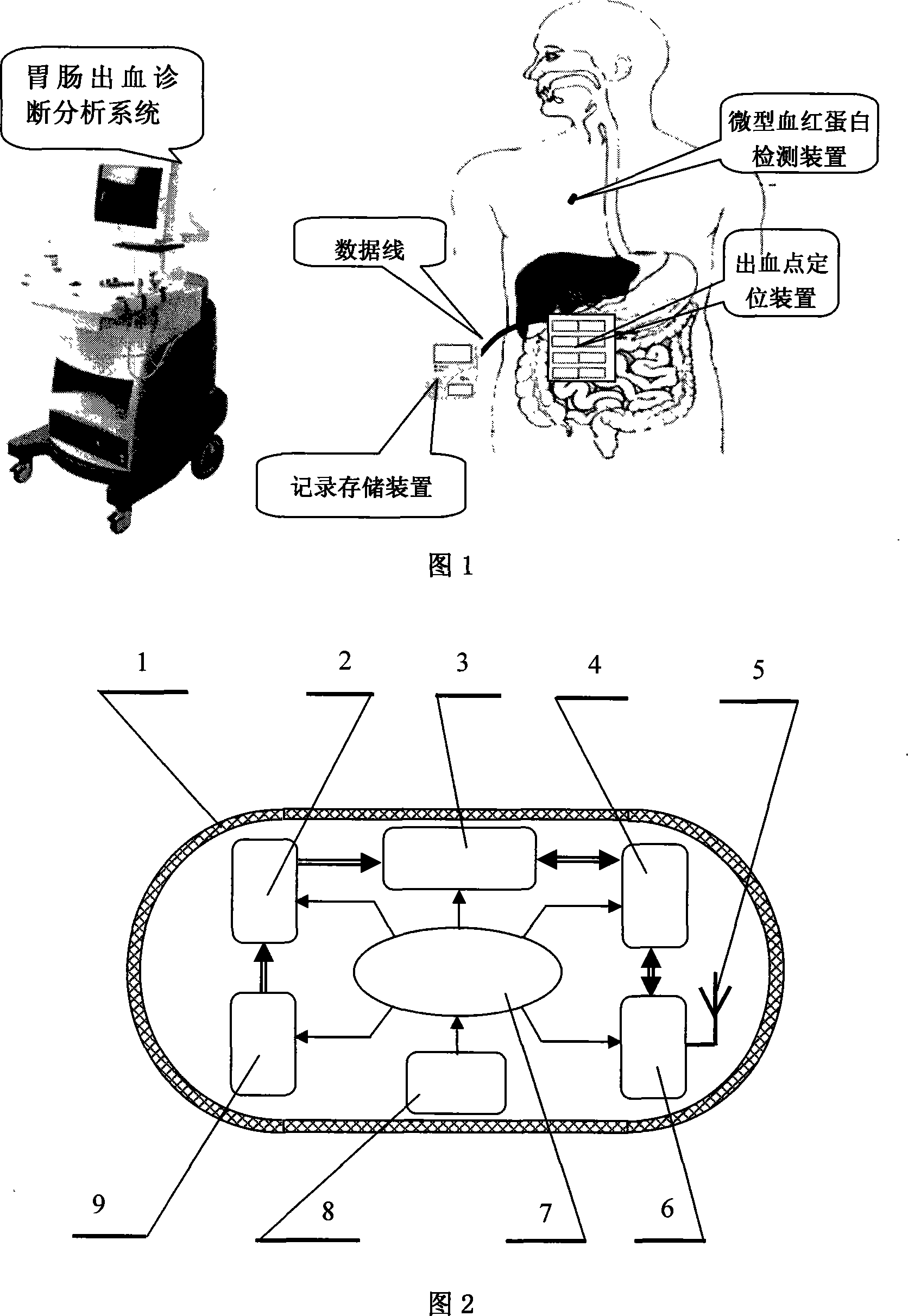 Gastrointestinal tract hemorrhage non-invasive monitoring system