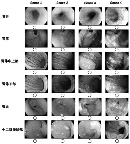 Gastric mucosa cleanliness evaluation method and system based on deep learning